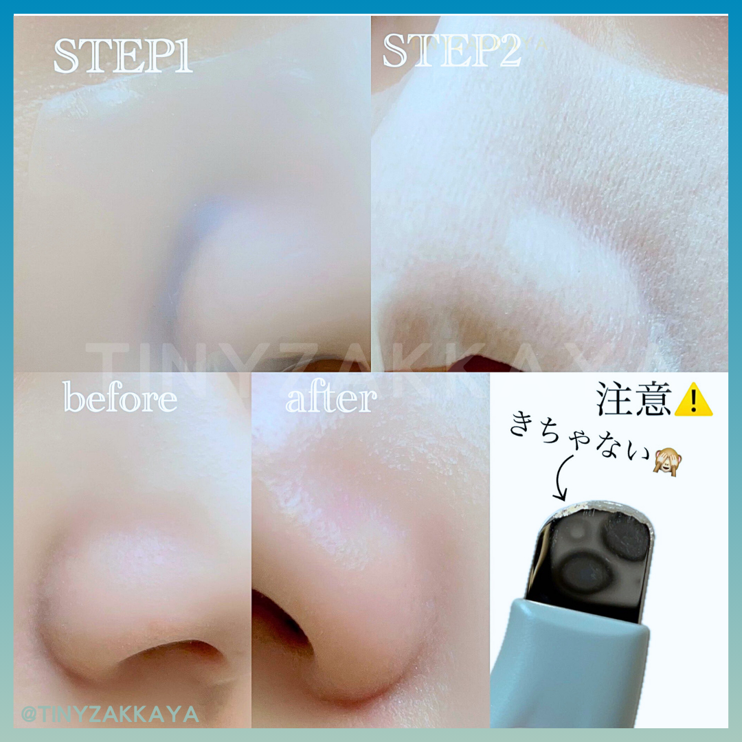 🇰🇷Korea ILSO Deep Clean Master|Apply and then scrape, blackhead-eliminating, out-of-stock | Stainless steel blackhead scraper
