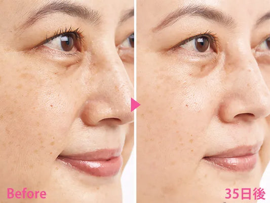 🇯🇵日本 SHISEIDO HAKU
melanofocus EV 驅黑淨白美白精華素美容液
Brightening Serum|HAKU最高傑作-日本連續18年NO.1 |