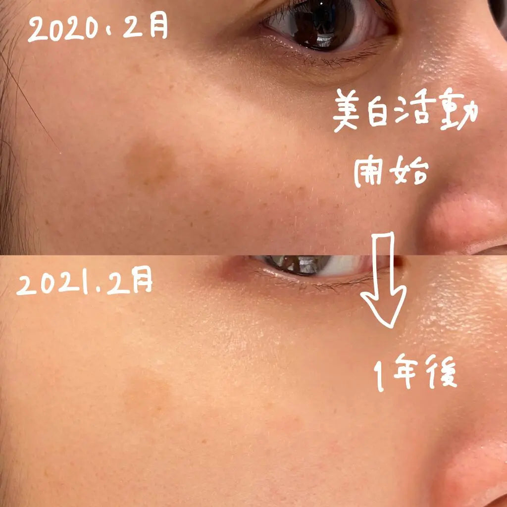 🇯🇵日本 SHISEIDO HAKU melanofocus EV Brightening Serum 驅黑淨白美白精華素美容液|HAKU最高傑作-日本連續18年NO.1 |