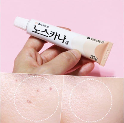 SALE 🇰🇷韓國 全新包裝｜可以去掉80%所有疤痕｜NOSCARNA 神奇祛印袪疤膏20g Dong-A Pharm Noscarna Acne Scars Removal Gel