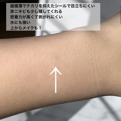 🇯🇵Japan♥ KOSE CLEAR TURN ごめんね素丝  
Medicated Anti-acne Skin Repair Acne Patches 46 Pieces
 Acne Spot Dressing Patch Pimple Stickers｜As thin as 0.05mm! Focused care for problem areas!｜ 