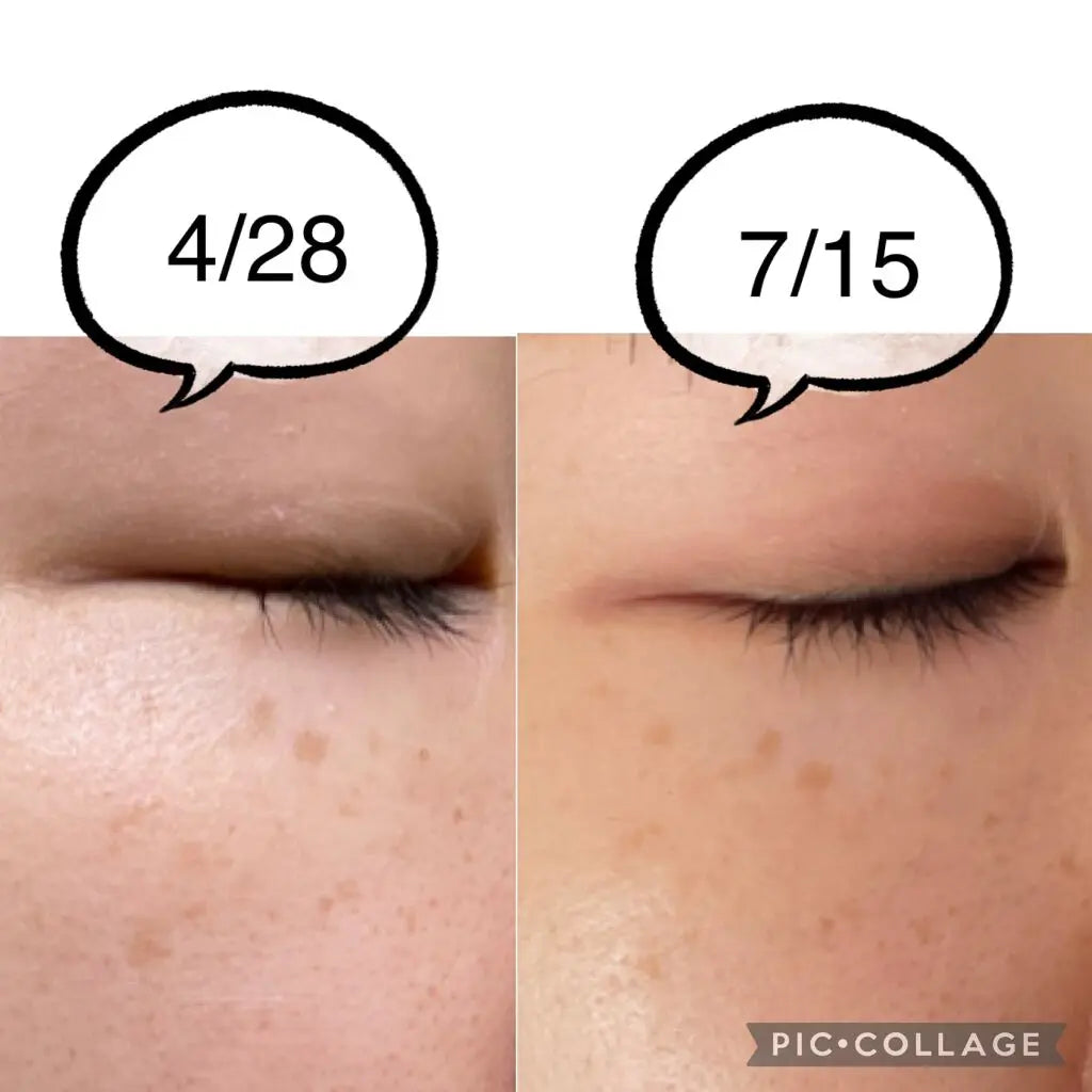 🇯🇵日本 SHISEIDO HAKU melanofocus EV Brightening Serum 驅黑淨白美白精華素美容液｜HAKU最高傑作-日本連續18年NO.1 ｜