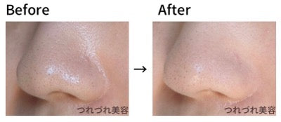 🇯🇵JAPAN 限定 ♥ ATTENIR Skin Clear Cleanse Oil Lavender 清爽薰衣草香 雙重潔淨無刺激護膚潔淨亮膚卸妝油 アテニア スキンクリアクレンズ オイル クリアネスラベンダーの香り / 175ml