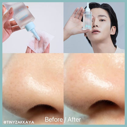 🇰🇷韓國 ILSO Super Melting Sebum Softener 150ml 黑頭粉刺導出液｜溫和無痛地溶走黑白頭、軟化老廢角質｜