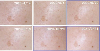 🇯🇵日本 SHISEIDO HAKU
melanofocus EV 驅黑淨白美白精華素美容液 
Brightening Serum｜HAKU最高傑作-日本連續18年NO.1 ｜