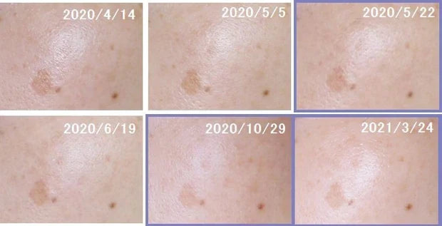 🇯🇵日本 SHISEIDO HAKU melanofocus EV Brightening Serum 驅黑淨白美白精華素美容液｜HAKU最高傑作-日本連續18年NO.1 ｜