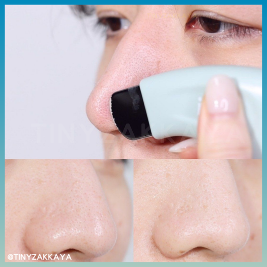 🇰🇷Korea ILSO Deep Clean Master｜Apply and then scrape, blackhead-eliminating, out-of-stock | Stainless steel blackhead scraper