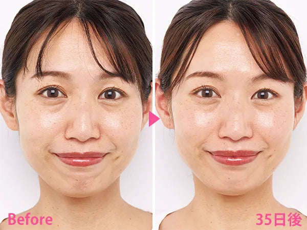 🇯🇵日本 SHISEIDO HAKU melanofocus EV Brightening Serum 驅黑淨白美白精華素美容液｜HAKU最高傑作-日本連續18年NO.1 ｜