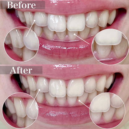 🇯🇵日本 牙膏界愛馬仕！APAGARD Premio 極致美白防敏修護琺瑯質無氟牙膏 金色 Premium / 粉紅色 Stain-care / 綠色 Premium Xtra Mint 105g  PREMIO Sangi's Medicinal Nano-Hydroxyapatite Toothpaste for Naturally Whiter Teeth Toothpaste アパガードプレミオ 歯磨き