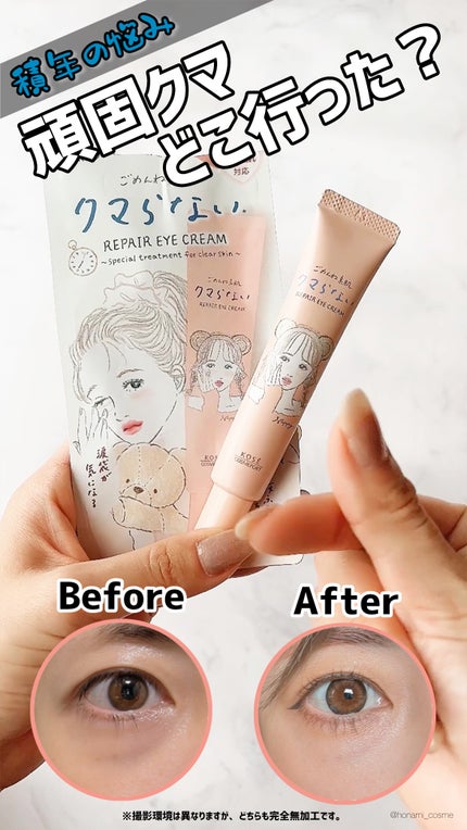 🇯🇵日本 ♥ 高絲 Kose Clear Turn 敏感肌適用去黑眼圈提亮修護眼霜 Repair Eye Cream for Sensitive Skin 20g クリアターン クリアターン ごめんね素肌 クマらないアイクリーム