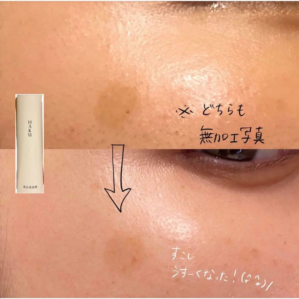 🇯🇵日本 SHISEIDO HAKU melanofocus EV Brightening Serum 驅黑淨白美白精華素美容液｜HAKU最高傑作-日本連續18年NO.1 ｜