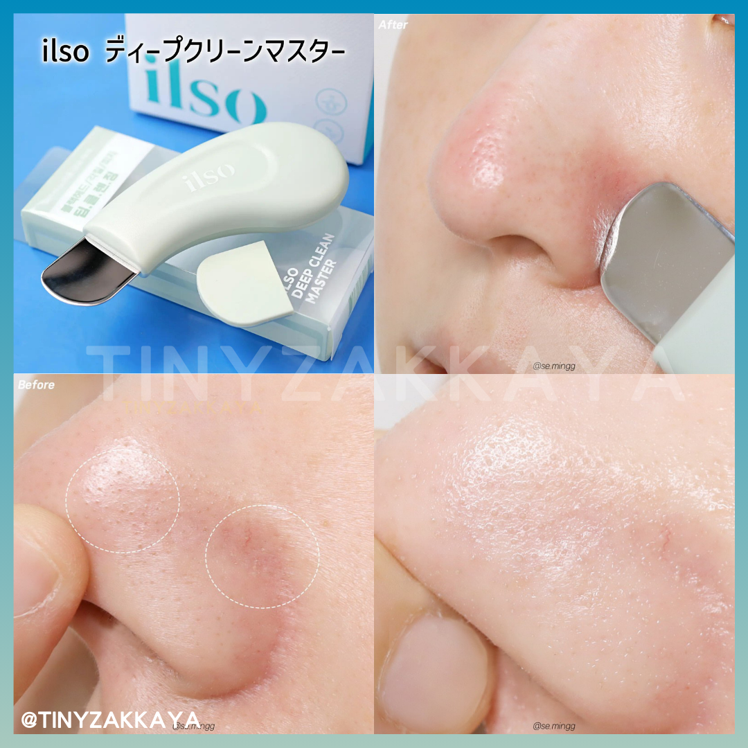 🇰🇷Korea ILSO Deep Clean Master｜Apply and then scrape, blackhead-eliminating, out-of-stock | Stainless steel blackhead scraper
