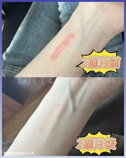 🇯🇵Japan♥HISAMITSU Hisamitsu Ogawa Scar Repair and Removal Patch
 HISAMITSU Eclar Plaster Keloid Scar Remover \ Any scar savior! Hong Kong doctors recommend scar removal patches/
 Hisamitsu's 薬エクラープラスター 20μg/cm2