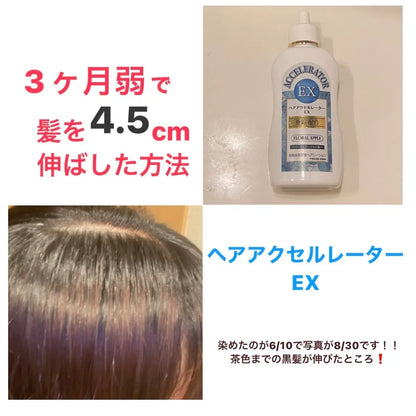 🇯🇵Japan KAMINOMOTO Honpo Hair Accelerator EX Floral Apple 150ml KAMINOMOTO Honpo Hair Accelerator EX Floral Apple 150ml 加美乃素本舗　ヘアアクセルレーターEX フローラルアップルの香り
