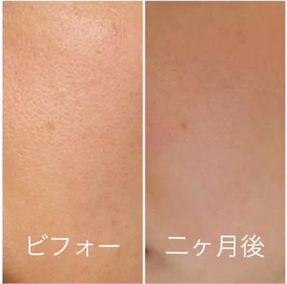 🇯🇵日本 SHISEIDO HAKU
melanofocus EV 驅黑淨白美白精華素美容液 
Brightening Serum｜HAKU最高傑作-日本連續18年NO.1 ｜