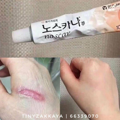 SALE 🇰🇷韓國 全新包裝｜可以去掉80%所有疤痕｜NOSCARNA 神奇祛印袪疤膏20g Dong-A Pharm Noscarna Acne Scars Removal Gel