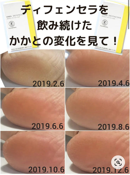 (特價售完即止)  🇯🇵日本｜造健康水潤的肌膚｜ORBIS Defencera 神經酰胺保濕粉 米潤美源素 オルビス ディフェンセラ 30日分 (副本)