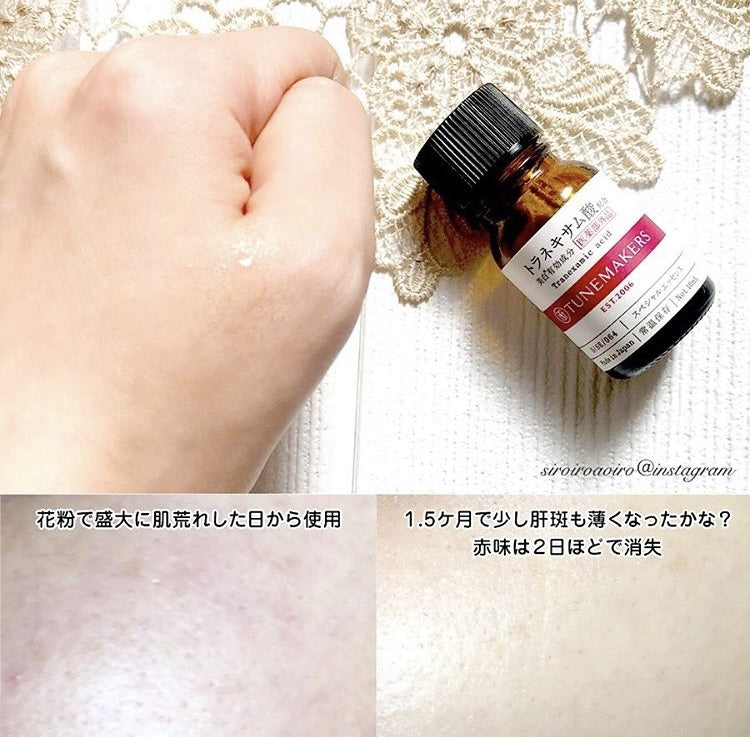 🇯🇵日本 Tunemakers 傳明酸藥用美白原液 Tranexamic Acid｜抑制雀斑和斑點，防止乾燥引致皮膚粗糙｜トラネキサム酸 10ml/30ml