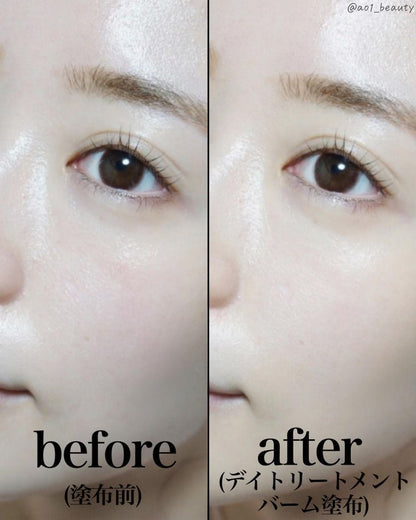 🇯🇵日本 PRIMAVISTA Day Treatment Balm Roller Foundation Limited Set｜肌膚有光澤不容易脫妝｜膏狀精華液氣墊滾輪粉底  SPF14 PA++  プリマヴィスタ デイトリートメントバーム ローラータイプ